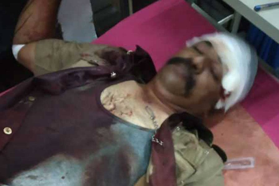 தகராறை தட்டிக் கேட்ட தலைமை காவலருக்கு அரிவாள் வெட்டு! 